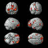 卡耐基梅隆大学的研究人员根据大脑活动来识别情绪