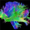 神经科学家关于网络如何变得有意识的激进理论