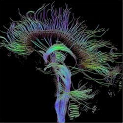 人脑中的神经纤维