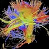 大脑制图:现代探险家正在绘制人类思维线路