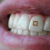 科学家开发了安装在牙齿上的传感器，可以跟踪你吃了什么