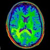从一个大脑扫描，更多的信息为医疗AI